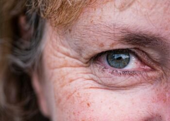 Concealer Help for Women Over 50: Dawn Pfingsten Shares Her Tips for Smooth, Crease-Free Coverage