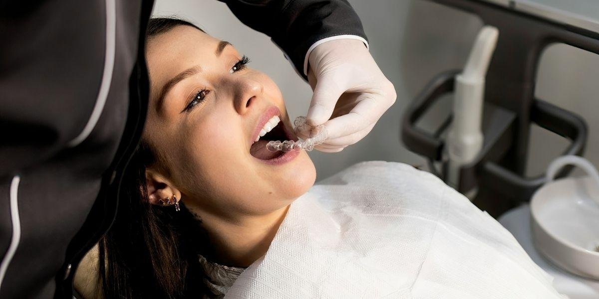Do Your Teeth Need Veneers? What Statistics Say About White Teeth and Attractive Smiles